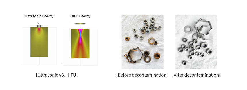 Ultrasonic VS. HIFU , Before decontamination, After decontamination